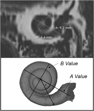 cochlear duct