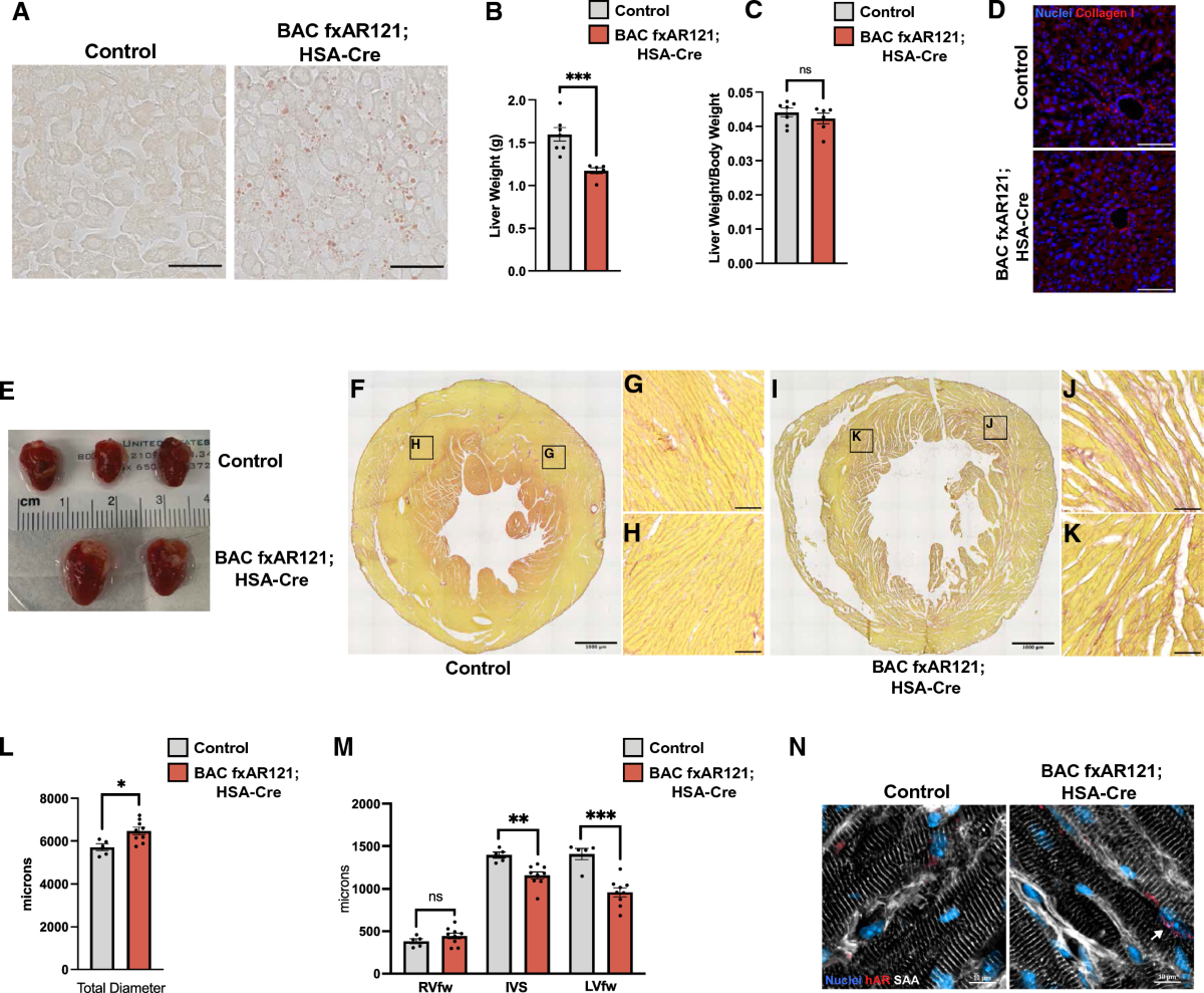 X-linked SBMA model mice display relevant non-neurological phenotypes and  their expression of mutant androgen receptor protein in motor neurons is  not required for neuromuscular disease | Acta Neuropathologica  Communications | Full Text