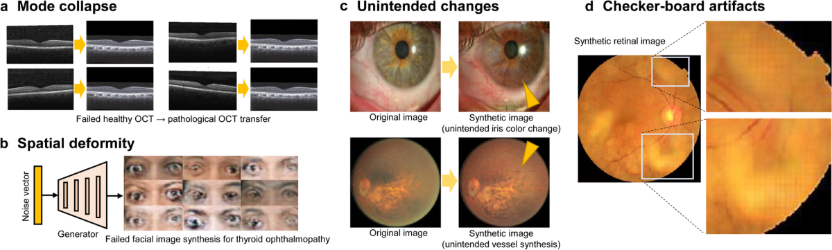 Application of generative adversarial networks (GAN) for ophthalmology  image domains: a survey | Eye and Vision | Full Text