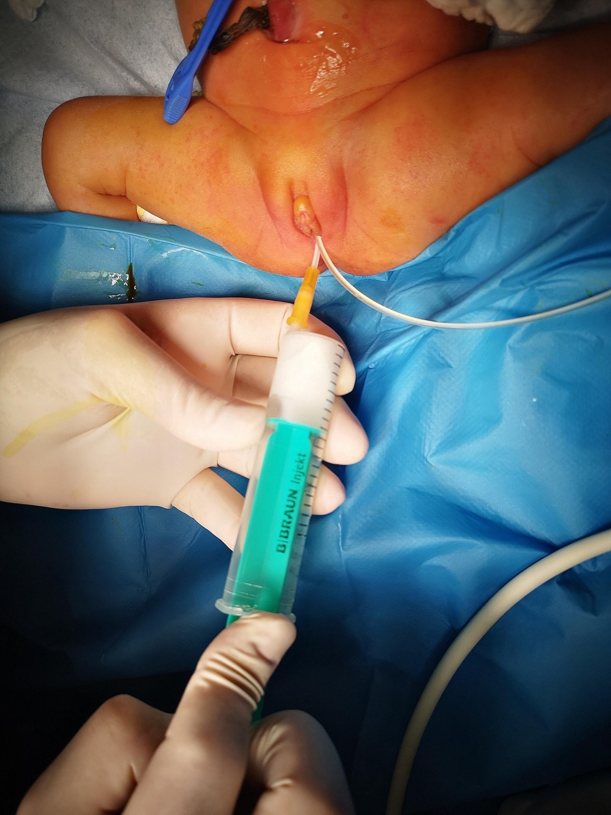 hymenal 