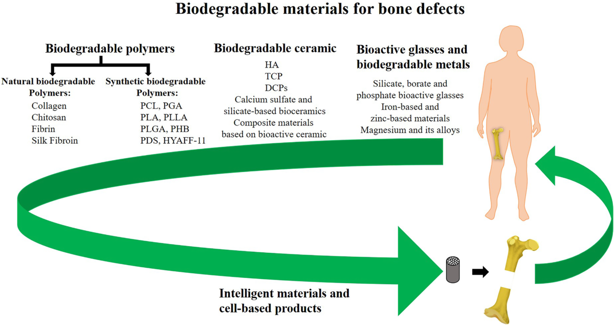 Biodegradable materials for bone defect repair | Military Medical 