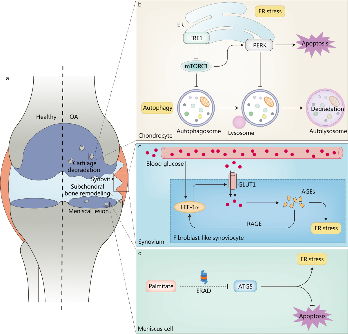 Insights into the underlying pathogenesis and therapeutic potential of  endoplasmic reticulum stress in degenerative musculoskeletal diseases |  Military Medical Research | Springer Nature Link