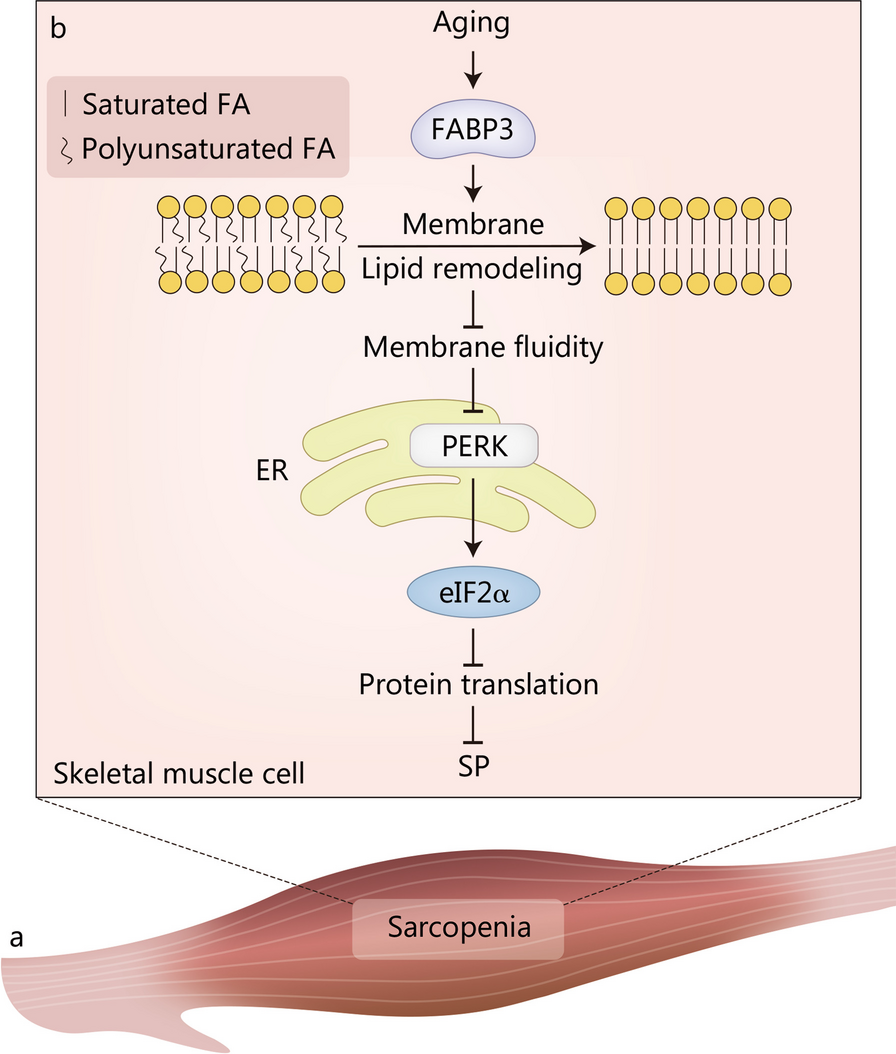 Insights into the underlying pathogenesis and therapeutic potential of  endoplasmic reticulum stress in degenerative musculoskeletal diseases |  Military Medical Research | Springer Nature Link