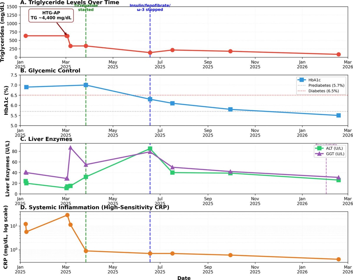 tirzepatide pancreatitis gallbladder risk PDF] Acute Caused by What are the considerations for