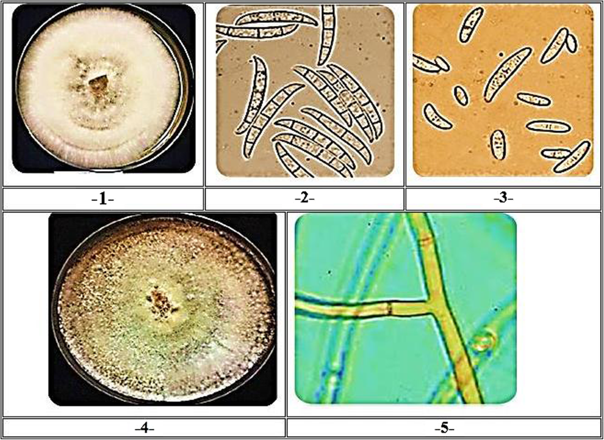 Isolation and molecular identification of Rhizoctonia solani and Fusarium  solani isolated from cucumber (Cucumis sativus L.) and their control  feasibility by Pseudomonas fluorescens and Bacillus subtilis | Egyptian  Journal of Biological Pest