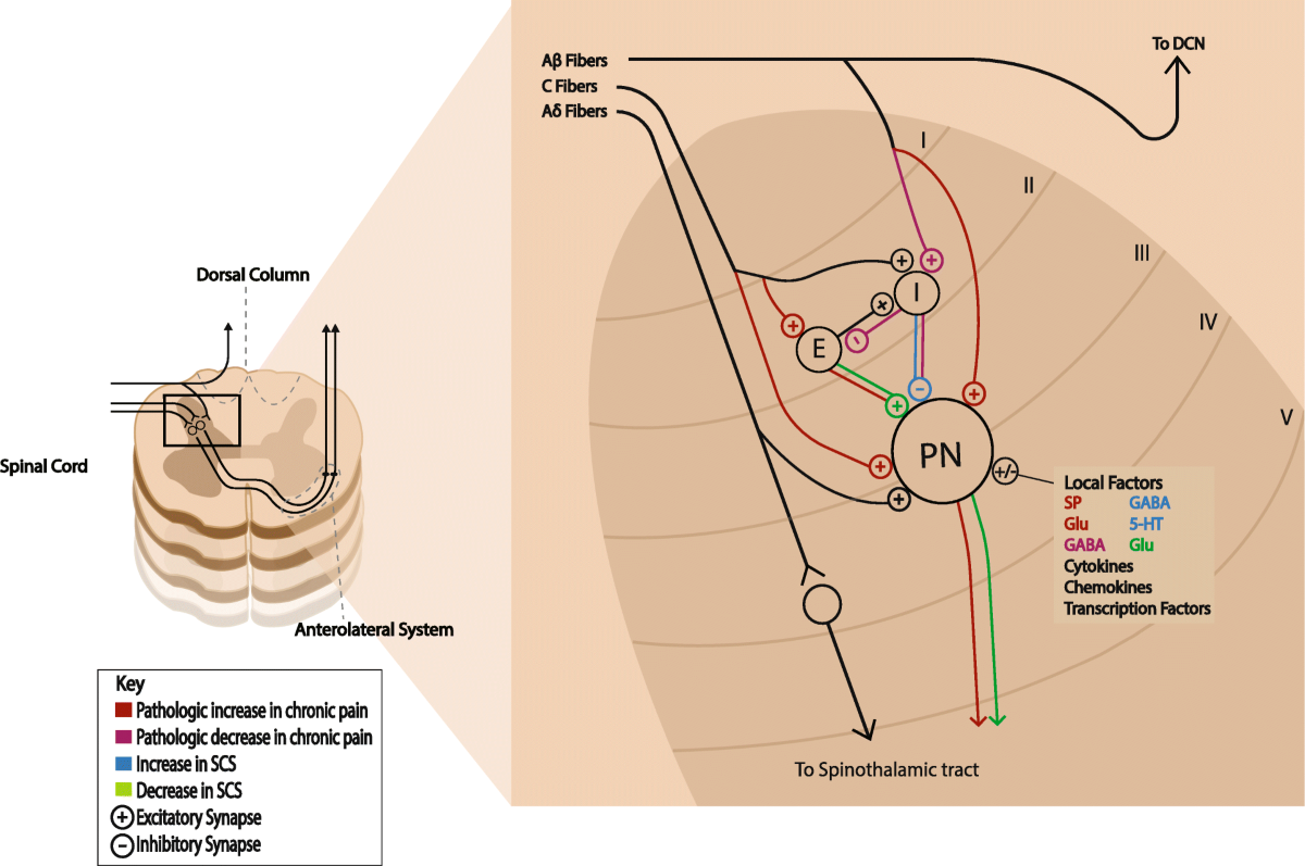 Effects of Injury on Modulation of Nociception 📘 Great illustration by  Martyn et al. (2019, NEJM) 👉 Tissue injury cause local and often systemic  inflammatory responses. These responses launch a cascade of, image size:1200x797