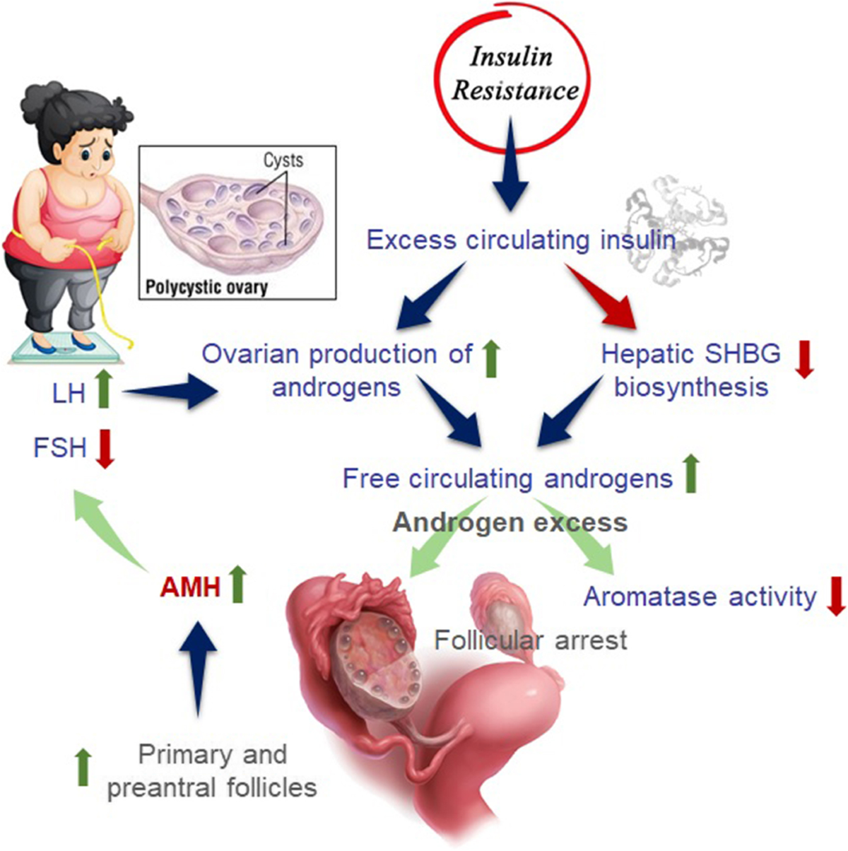 Role of anti-Mullerian hormone in polycystic ovary syndrome 