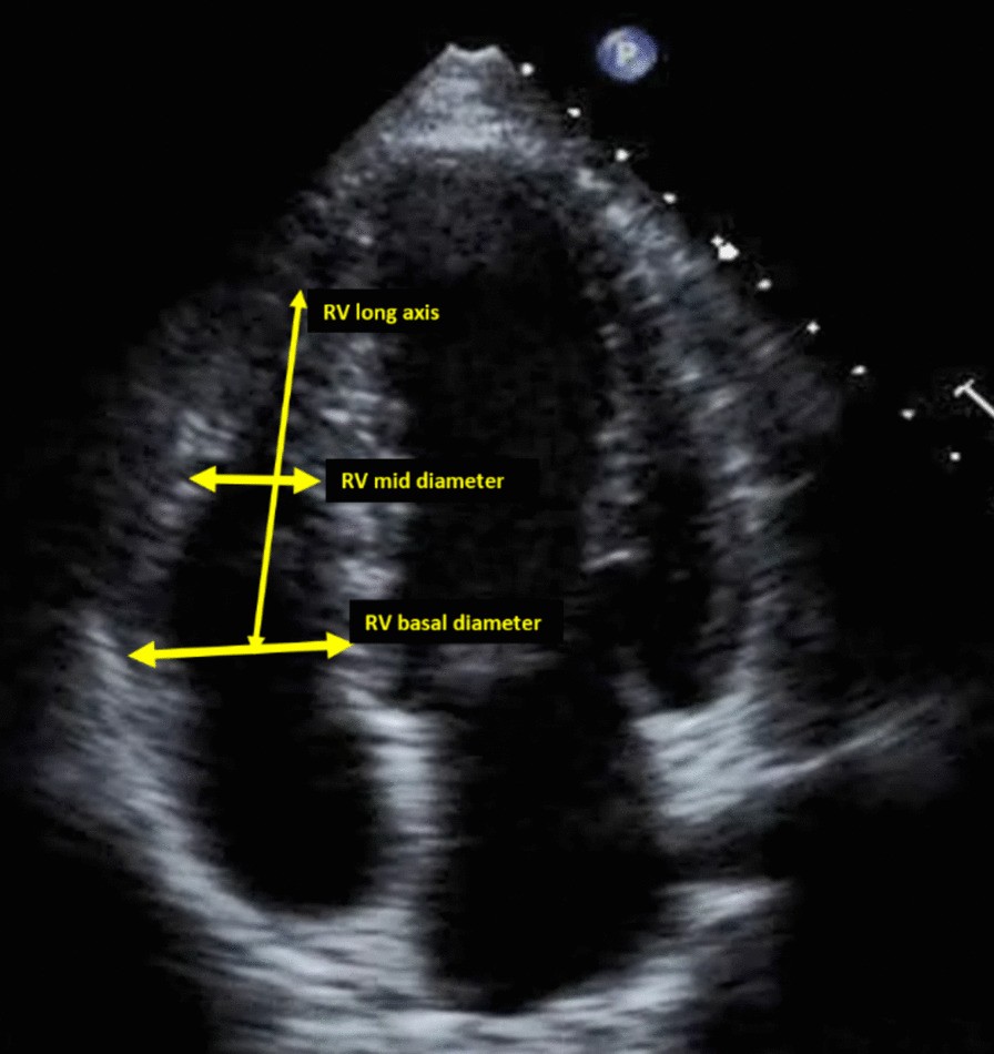 Unified adult transthoracic echocardiographic report: an expert consensus  document of the Egyptian Working Group of Echocardiography | The Egyptian  Heart Journal | Springer Nature Link