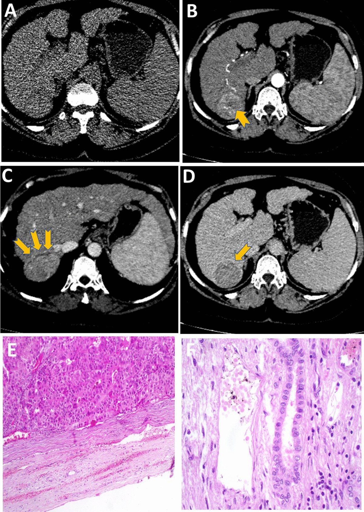 progress in healthcare