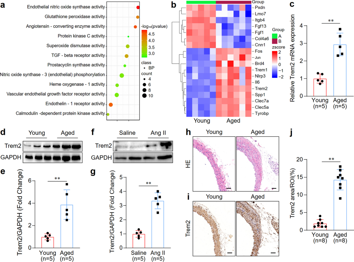 Macrophage Trem2 deficiency aggravates aging-induced vascular remodeling by acting as a non-classical receptor of interleukin-13 | Molecular Biomedicine