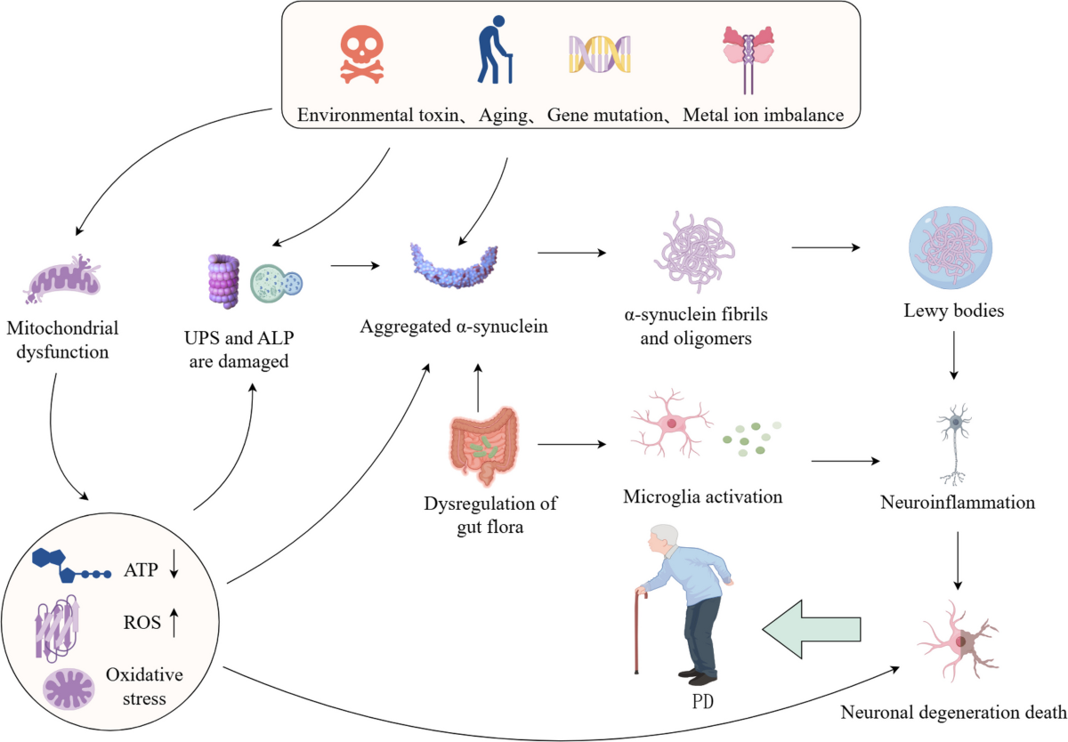 glutathione ala alzheimers Molecular Medicine Reports