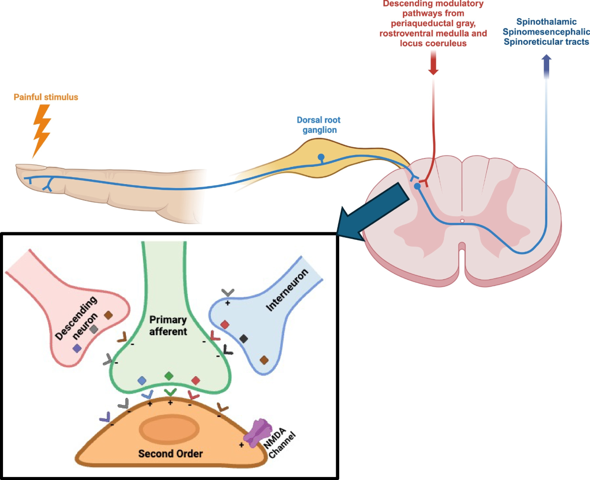 Chronic Pain and Its Treatment (Chapter 9) - Stahl's Essential  Psychopharmacology, image size:1200x975