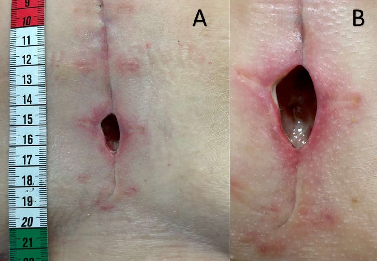 Frontiers | Antibodies to S2 domain of SARS-CoV-2 spike protein in Moderna  mRNA vaccinated subjects sustain antibody-dependent NK cell-mediated cell  cytotoxicity against Omicron BA.1, image size:1200x830