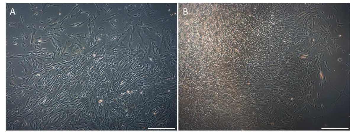Mammary gland derived nestin positive cell populations can be  