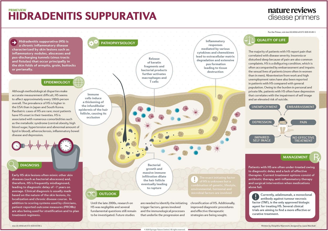 Hidradenitis suppurativa | Nature Reviews Disease Primers