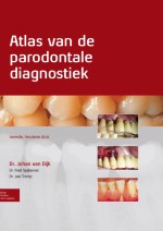 6 Parodontitis en algemene gezondheid