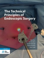 Single Incision Laparoscopic Surgery (SILS)