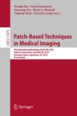 Learning Real Noise for Ultra-Low Dose Lung CT Denoising