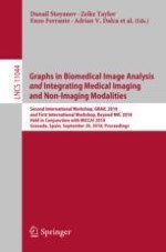 Graph Saliency Maps Through Spectral Convolutional Networks: Application to Sex Classification with Brain Connectivity