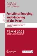 Population-Based Personalization of Geometric Models of Myocardial Infarction