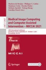 Learning More for Free - A Multi Task Learning Approach for Improved Pathology Classification in Capsule Endoscopy