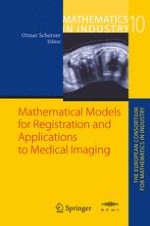 A Generalized Image Registration Framework using Incomplete Image Information – with Applications to Lesion Mapping