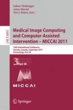 Sliding Window and Regression Based Cup Detection in Digital Fundus Images for Glaucoma Diagnosis