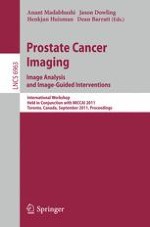 A Learning Based Hierarchical Framework for Automatic Prostate Localization in CT Images