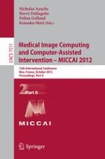 Automatic Multi-model-Based Segmentation of the Left Atrium in Cardiac MRI Scans