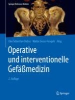 Geschichtliche Entwicklung der Venenchirurgie