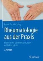 Diagnose und Differenzialdiagnose entzündlich-rheumatischer Erkrankungen