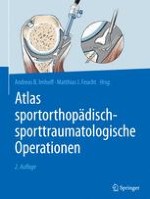 Lagerung, Arthroskopieportale, arthroskopische Diagnostik, arthroskopische Rutschknoten