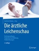 Herkunft, Aufgaben und Bedeutung der Leichenschau