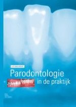 1 Aandacht voor het parodontium