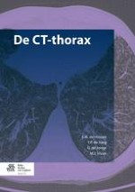 1 Techniek, indicaties en (relatieve) contra-indicaties van de CT-thorax