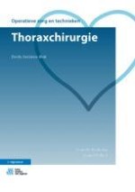 Geschiedenis van de thoraxchirurgie en algemene principes van dit boek