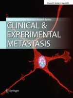 Clinical & Experimental Metastasis 6/2012