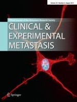 Clinical & Experimental Metastasis 6/2013