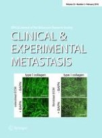 Clinical & Experimental Metastasis 2/2016