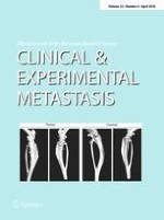 Clinical & Experimental Metastasis 4/2016
