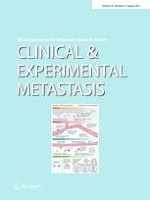 Clinical & Experimental Metastasis 4/2021