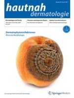 hautnah dermatologie 1/2017