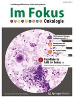 Im Fokus Onkologie 10/2013
