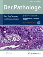 Schilddrüsenkarzinome | Vorschlag zu einer erweiterten pTNM-Klassifikation  der Schilddrüsenkarzinome | springermedizin.de