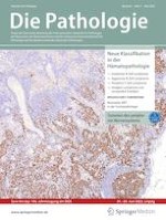 NSCLC | Biomarker MET in der Tumorpathologie | springermedizin.de