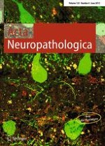 Acta Neuropathologica 6/2013