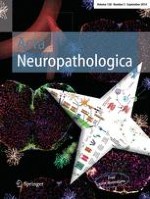 Acta Neuropathologica 3/2014