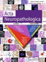 Acta Neuropathologica 6/2015