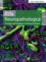 Acta Neuropathologica 4/2016