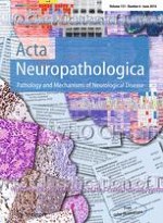 Acta Neuropathologica 6/2016